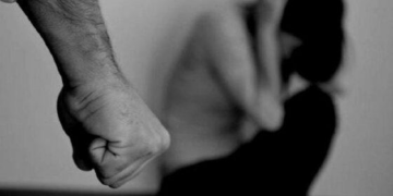 Mulher é espancada pelo ex e tem dentes quebrados